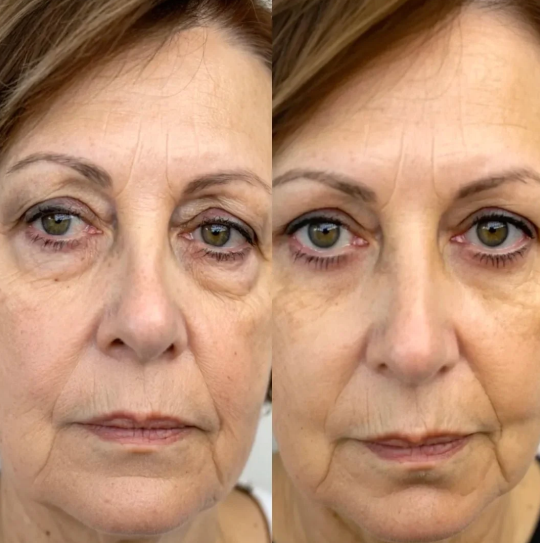 The Bloom Eye Repair Stick For Dark Circles