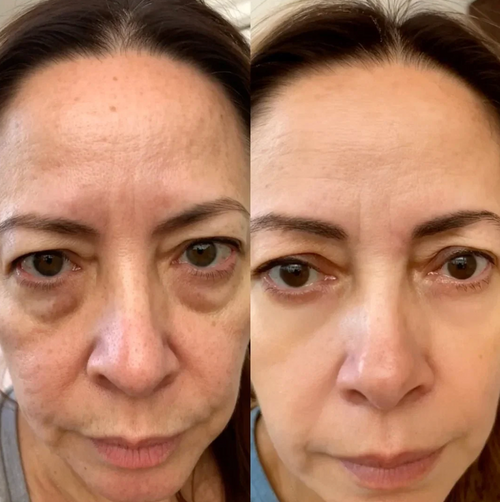 The Bloom Eye Repair Stick For Dark Circles