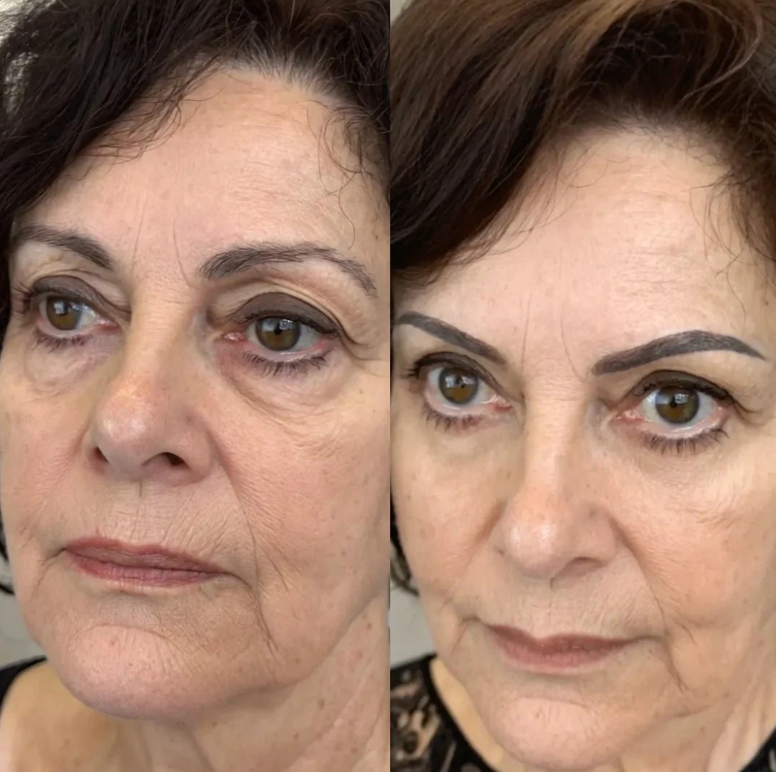 The Bloom Eye Repair Stick For Dark Circles